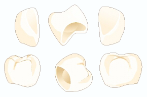 セラミッククラウン